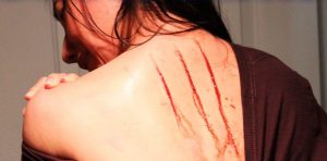 lesões e arranhões que aparecem durante a noite