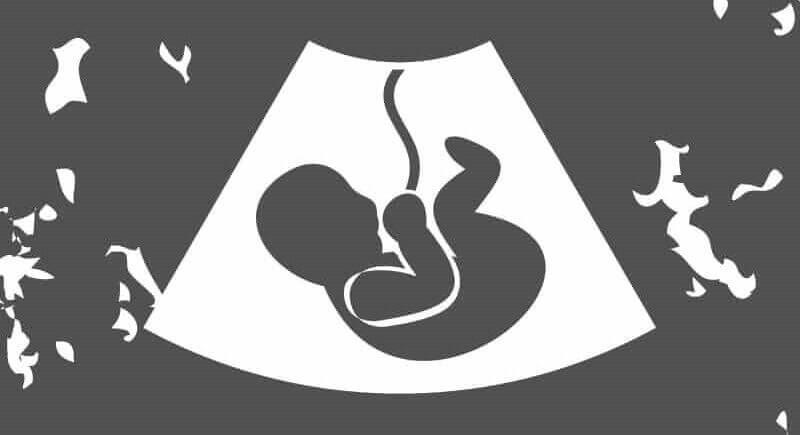 não poste imagem de ultrasson