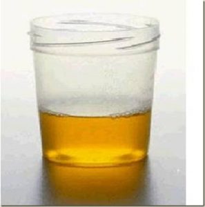 Leia mais sobre o artigo ▷ Sonhar com Urina【INTERPRETAÇÕES REVELADORAS】