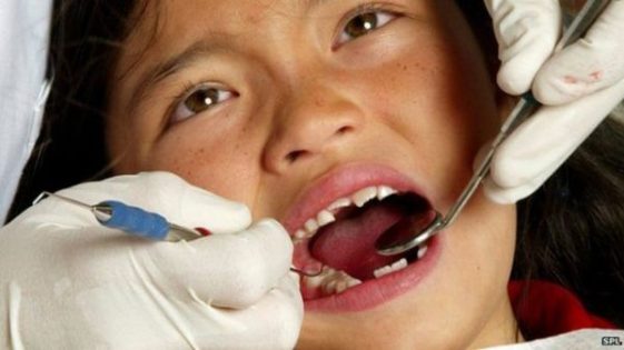 dentista arrumando dente quebrado