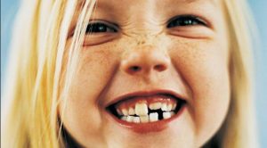 Leia mais sobre o artigo ▷ Sonhar Com Dente Caindo (Espiritismo)