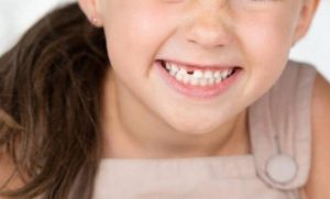 Leia mais sobre o artigo ▷ Sonhar Arrancando Dente é Mau Presságio?