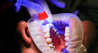 ▷ Sonhar com Dentista 【Tudo o que você precisa saber】