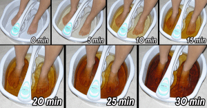 Leia mais sobre o artigo Você Pode Desintoxicar Seu Corpo Através Dos Pés – Veja Como