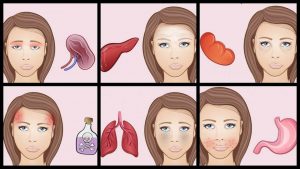 Leia mais sobre o artigo Leia o Seu Rosto Para Saber Quando Algo Está Errado Com o Seu Corpo