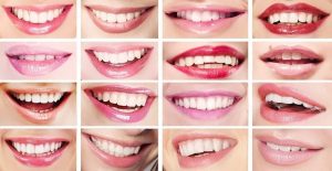 Leia mais sobre o artigo O Que a Forma Do Seu Sorriso Diz Sobre Você?