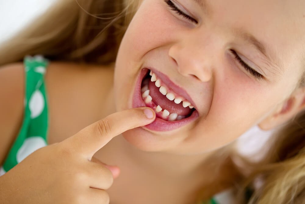 Significado de sonhar com dente podre caindo. Compreenda-o!