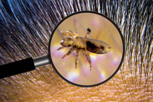 Leia mais sobre o artigo ▷ Sonhar Matando Piolho – Significa Notícias Ruins?