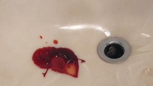 Leia mais sobre o artigo ▷ Sonhar Cuspindo Sangue 【Não se assuste com o significado】