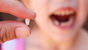 Leia mais sobre o artigo ▷ Sonhar Que o Dente Caiu é Mau Presságio?