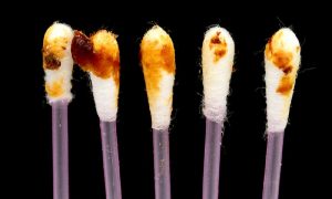 Leia mais sobre o artigo ▷ Sonhar Com Cera De Ouvido Significa Má Sorte?