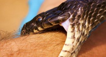 Sonhar Com Picada De Cobra Na Perna – Significa o Quê?