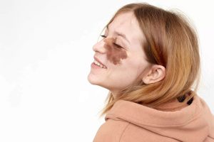 Leia mais sobre o artigo Marcas de nascença: 9 Significados espirituais 